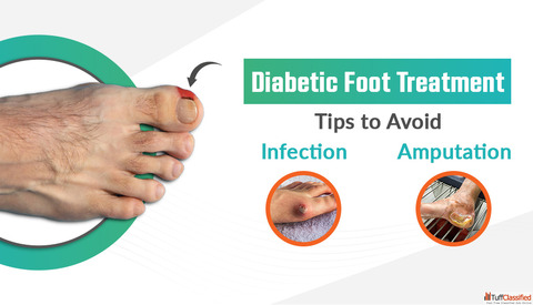 Diabetic Foot Treatment