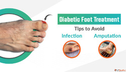 Diabetic Foot Treatment