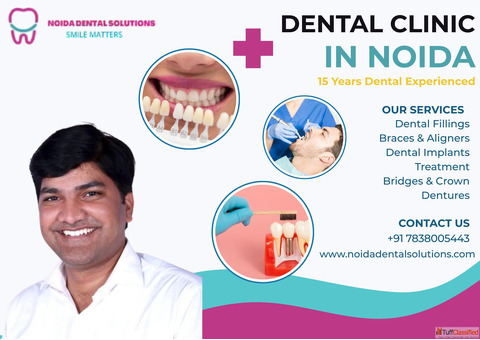 Experience the Best Care at Our Dental Clinic in Noida