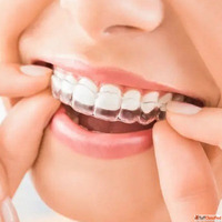 Dental Appliances in Dubai