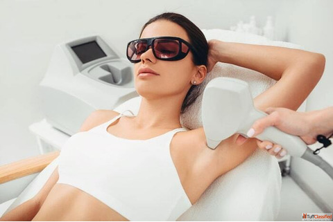 Laser Hair Removal in Kingston Ontario
