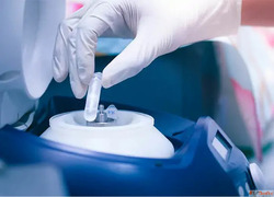 Expert Infertility Care - Infertility specialist in bangalor...