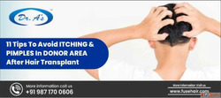 Itching After Hair Transplant Best Hair Fall Treatment in In...