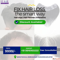 Fix Hair Loss the Smart Way Safe and Natural