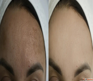 Looking for a Reliable Skin Clinic in Thrissur