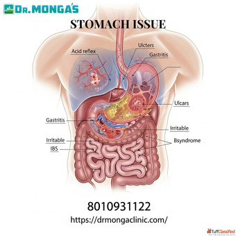 Doctor for stomach ulcer in Man Sarovar park