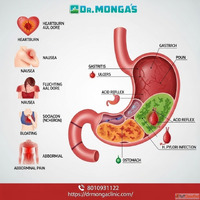 Good stomach doctor in Loni Road housing complex