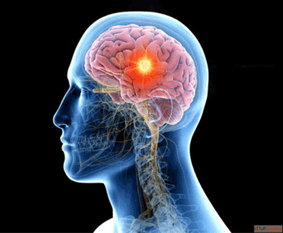 Best Neurosurgeon in Ghaziabad