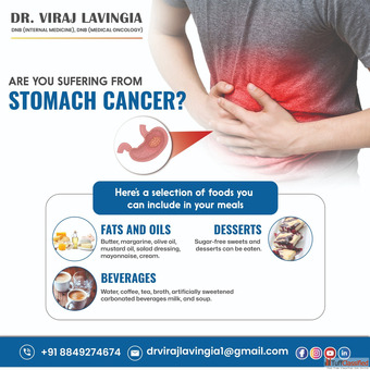 Best Stomach Cancer Treatment in Ahmedabad by Dr. Viraj Lavingia