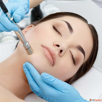 Microdermabrasion