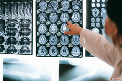 Top Neurology Hospital in Gwalior - Comprehensive Brain Nerv...
