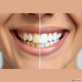 Best Dental Clinic in Esplanade