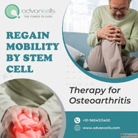 Regain Mobility By Stem Cell Therapy for Osteoarthritis