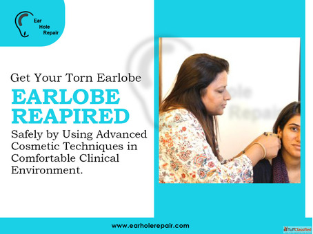 Auroplasty in Mumbai - Trusted Earlobe Hole Repair Specialists
