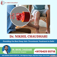 Dr. Nikhil Chaudhari Best Deep Vein Thrombosis Treatment In ...
