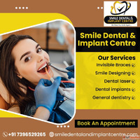 Top Dentist and Dental Clinic near Neredmet Secunderabad