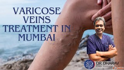 Improve Leg Health with Modern Care by Dr. Dharav Kheradia