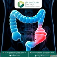 Best Colon Cancer Treatment in Ahmedabad India - Book Your C...