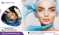 Surat's Trusted Plastic Surgeon - Callisto Clinic