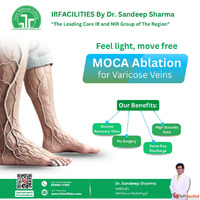 Best Hospital for Varicose Vein Treatment in India Your Path...
