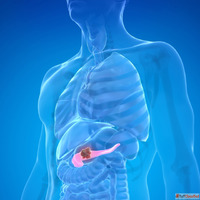 Advanced Pancreatic Care with Precision Surgery in India