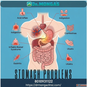 Best doctor in New Seemapuri for stomach ulcer