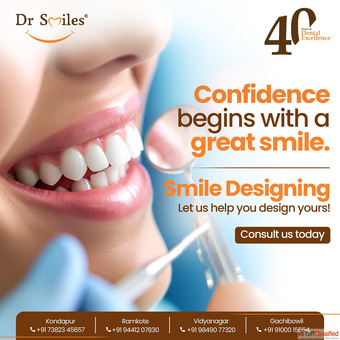 Smile Designing in Kondapur - Dr Smiles