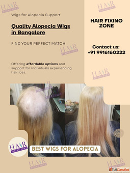 Quality Alopecia Wigs in Bangalore Hair Fixing Zone