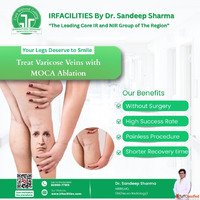 Varicose Veins Treatment in India Advanced Care for Healthy ...