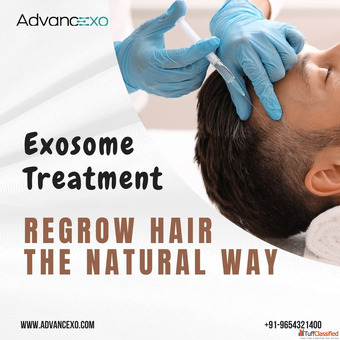 Exosome Treatment Regrow Hair the Natural Way