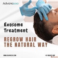 Exosome Treatment Regrow Hair the Natural Way