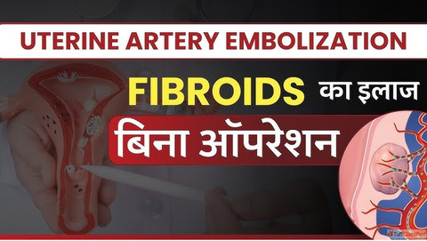 Get Effective Uterine Fibroids Treatment from Dr. Dharav Kheradia in MumbaiIndia