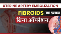 Get Effective Uterine Fibroids Treatment from Dr. Dharav Khe...