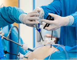 Best Laparoscopic Training