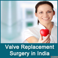 Top Heart Valve Specialist in india