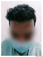 Looking for the Best Hair Care Clinic in Coimbatore