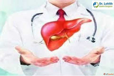 Best Laparoscopic Liver Surgeon in Sarjapur road - Dr. Lohith U