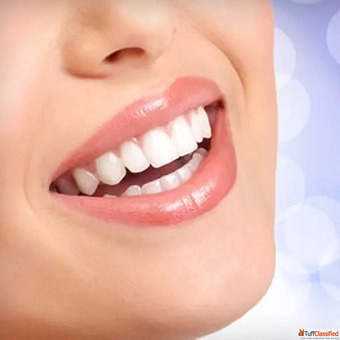Teeth Whitening in Dubai
