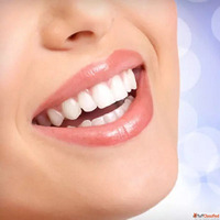 Teeth Whitening in Dubai