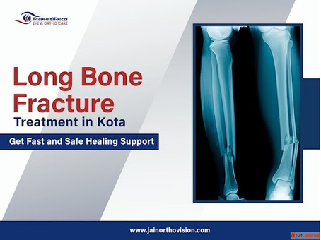 Long Bone Fracture Care in Kota - Consult Top Orthopedic Specialist