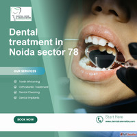 TMJ Treatment in Noida - Regain Comfort Balance
