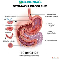 Doctor in Shakarpur for stomach ulcerDoctor in Shakarpur for...
