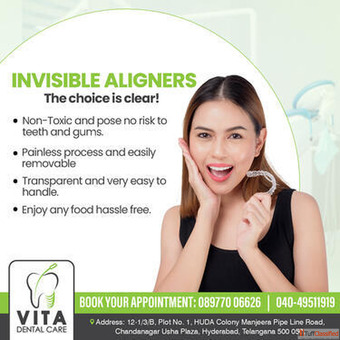 Invisible Braces in Chandanagar Vita Dental Care