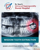 Wisdom Tooth Extraction What to Expect How to Prepare