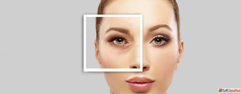 Who is an Ideal Candidate for Lower Blepharoplasty Surgery