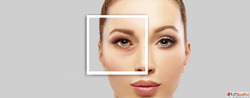 Who is an Ideal Candidate for Lower Blepharoplasty Surgery