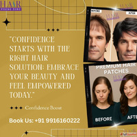"Confidence starts with the right hair solution"