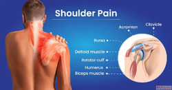 Effective Homeopathy Medicine for Right Shoulder Pain Relief