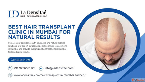 Best Hair Transplant Clinic in Mumbai for Natural Results