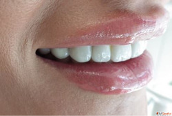 Cosmetic Dentist Adelaide